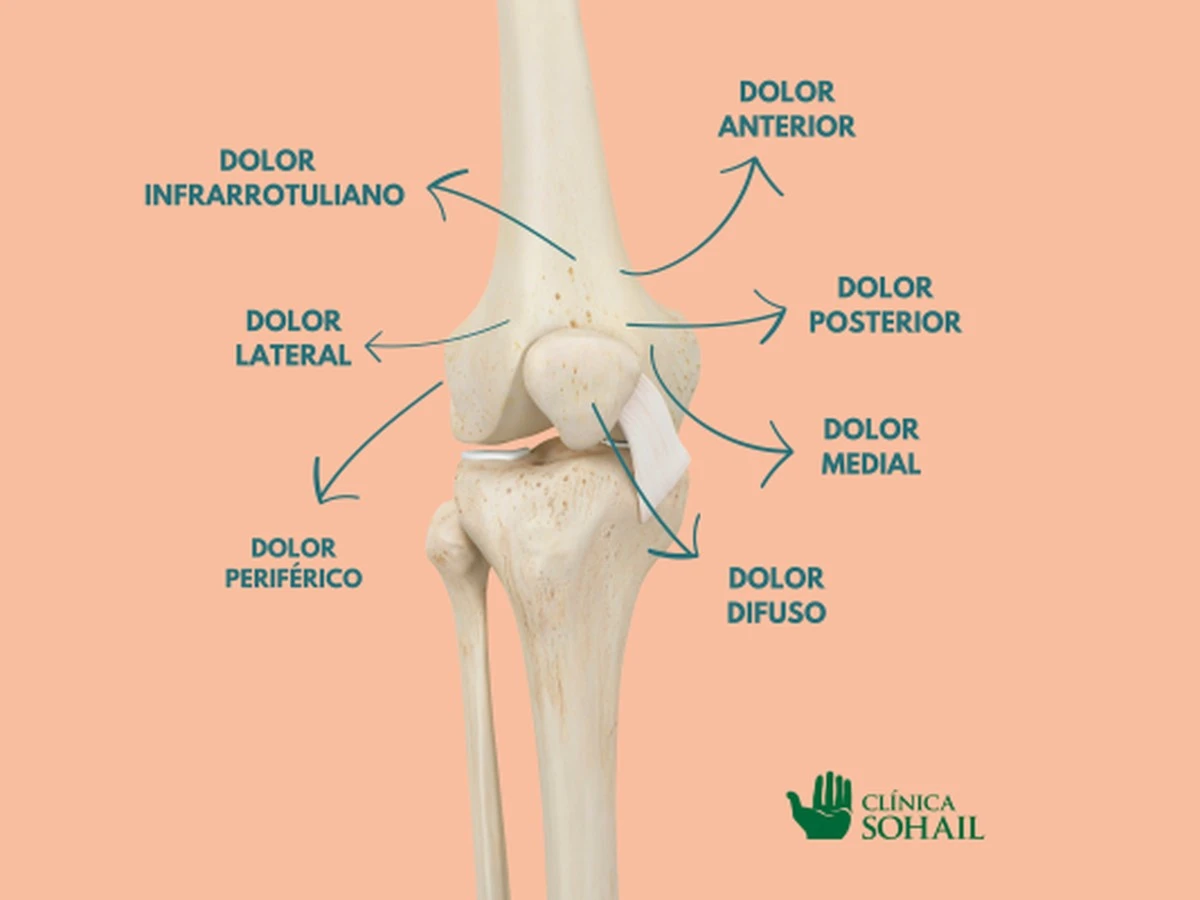 Alivio del dolor de rodilla: mi secreto de cocina que me liberó en 10 días - image 1