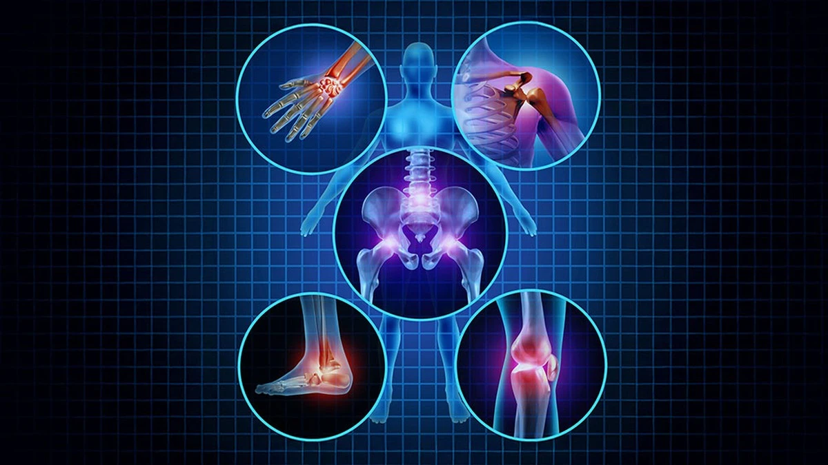 doloresdearticu-extra-1.webp Dolores de articulaciones: kéfir con cúrcuma, el remedio que alivia en una semana - image 1