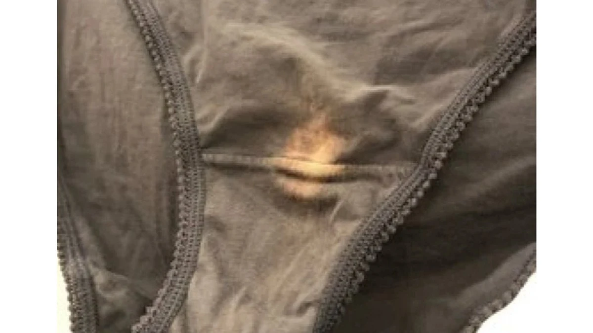 ¿Manchas blancas en tu ropa interior? La médica revela su verdadero y sorprendentemente natural significado