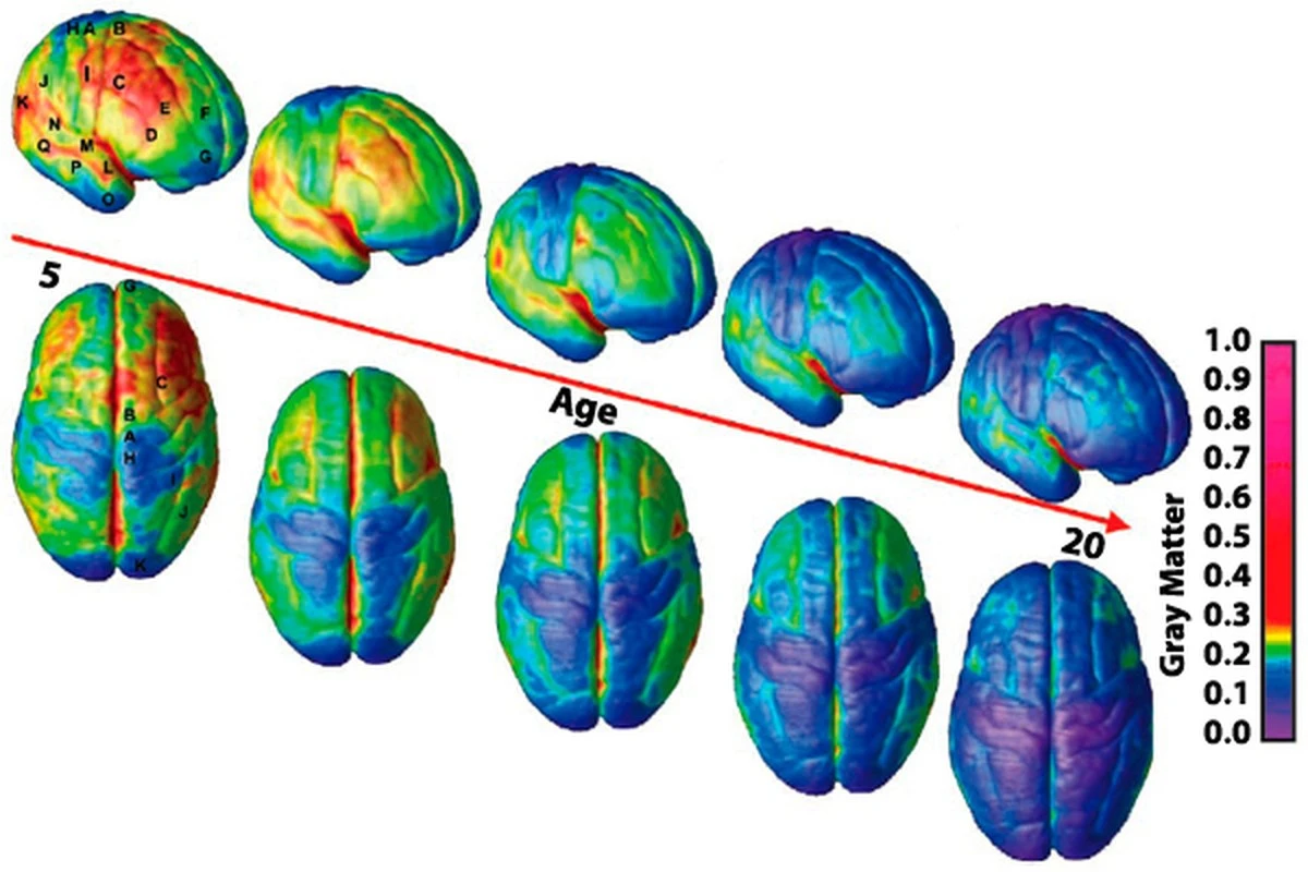 El cerebro cambia hasta los 32: Descubre cuándo te conviertes realmente en adulto - image 1