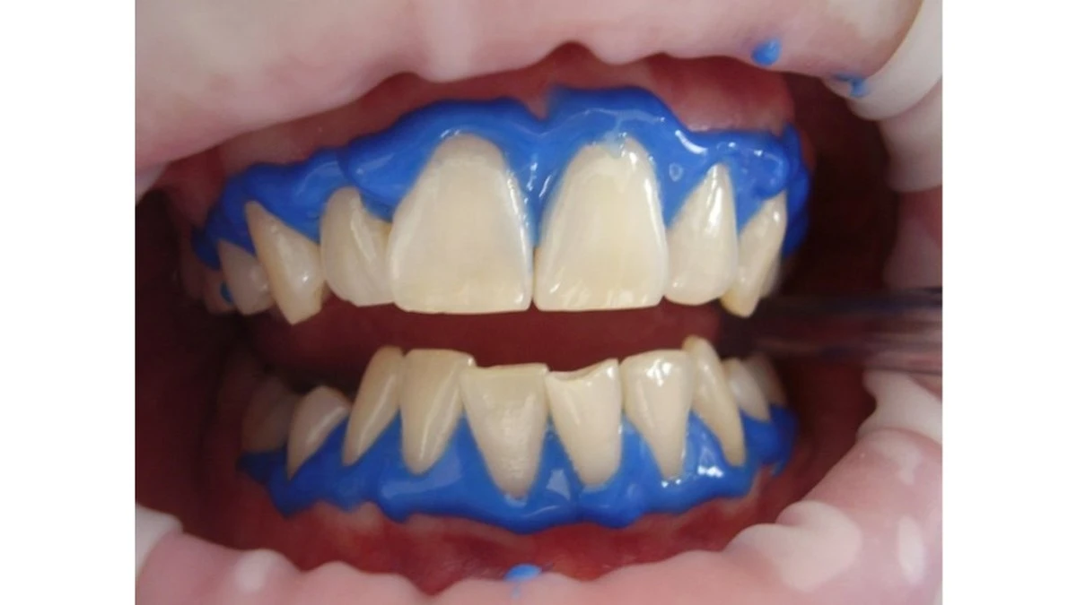 Por qué los dentistas recomiendan evitar estos trucos virales para blanquear los dientes