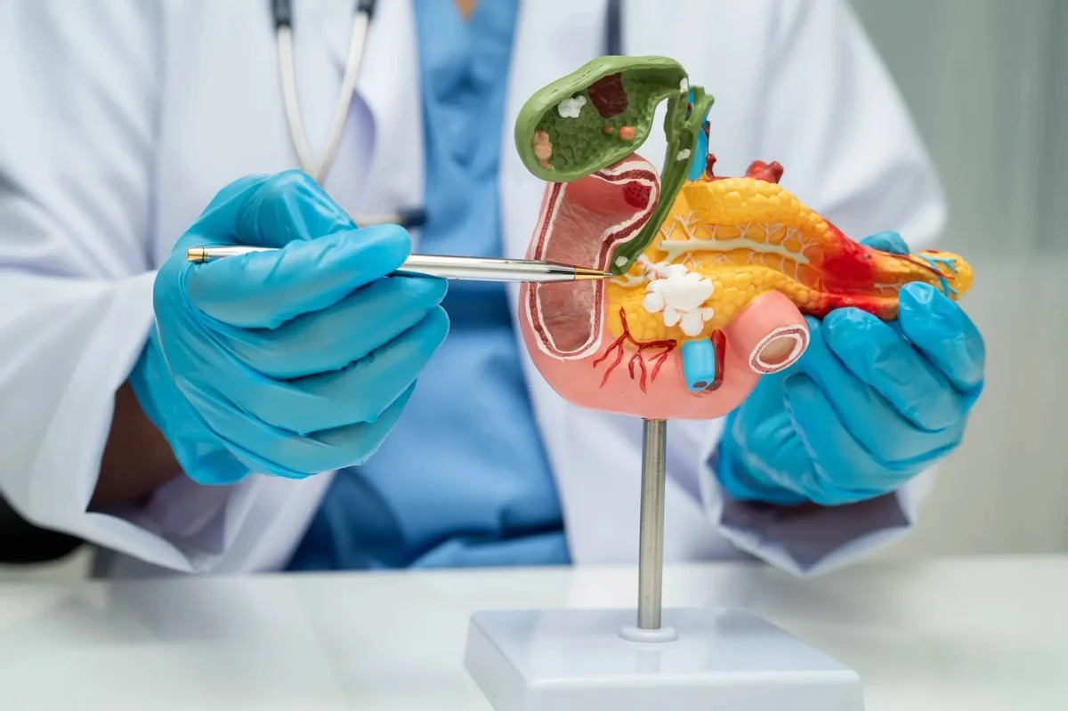 El cáncer de páncreas te avisa años antes: no ignores estas señales de alerta