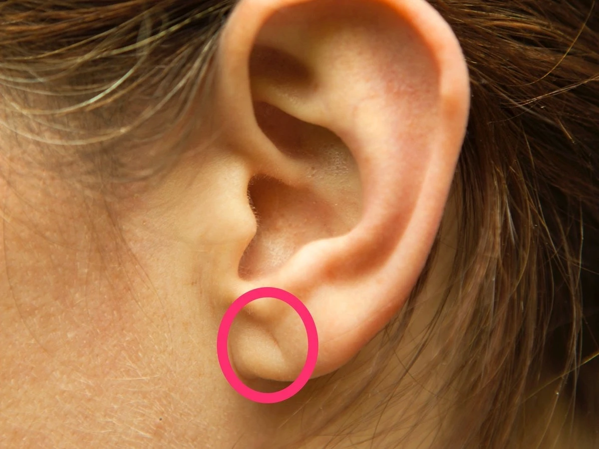 Una arruga en tu oreja podría ser la señal silenciosa de tu corazón - image 1
