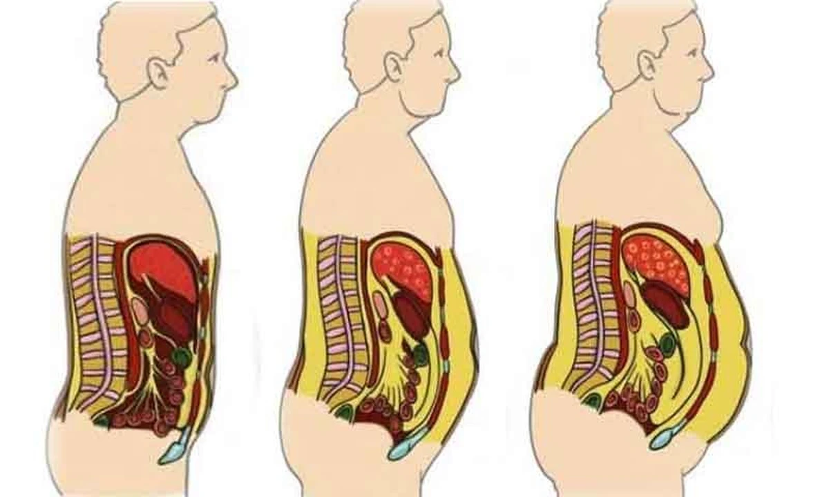 El abdomen duro y redondo en hombres: una señal más seria de lo que crees - image 1