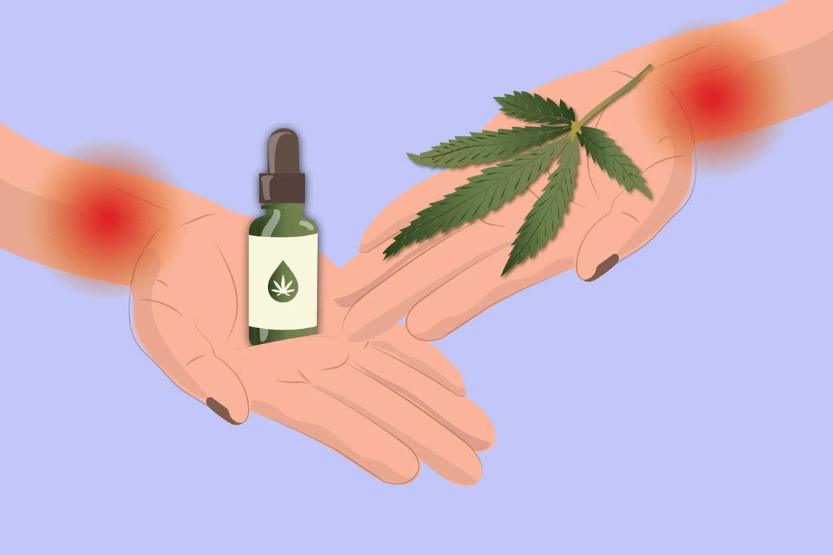 Cannabis para el dolor nervioso: ¿un alivio real o una esperanza vacía? - image 1