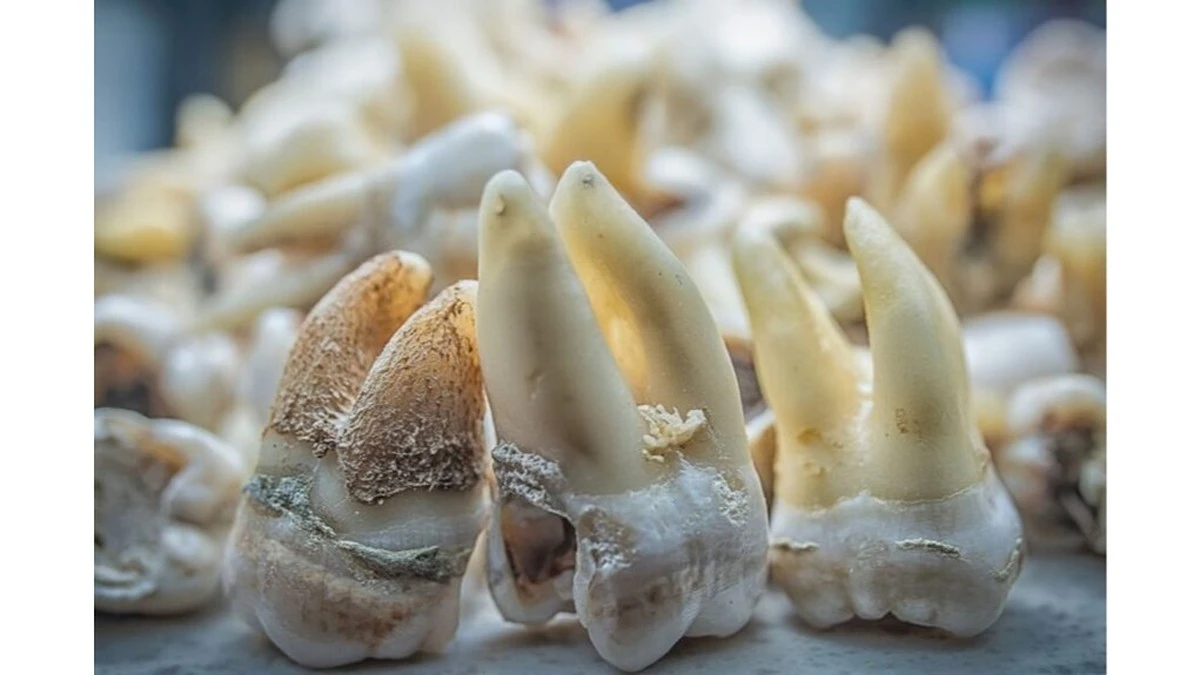 Lo que descubrieron en 51 dientes fosilizados cambia nuestra historia con el plomo