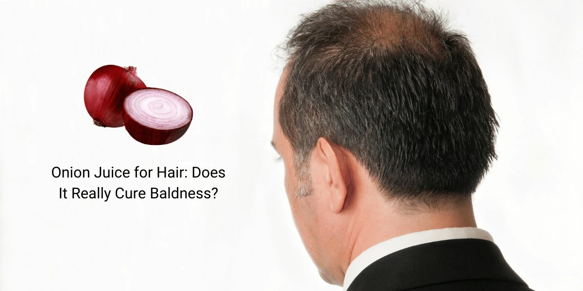 La cebolla en tu cabeza: resultados que tu peluquero notará en 2 meses - image 1