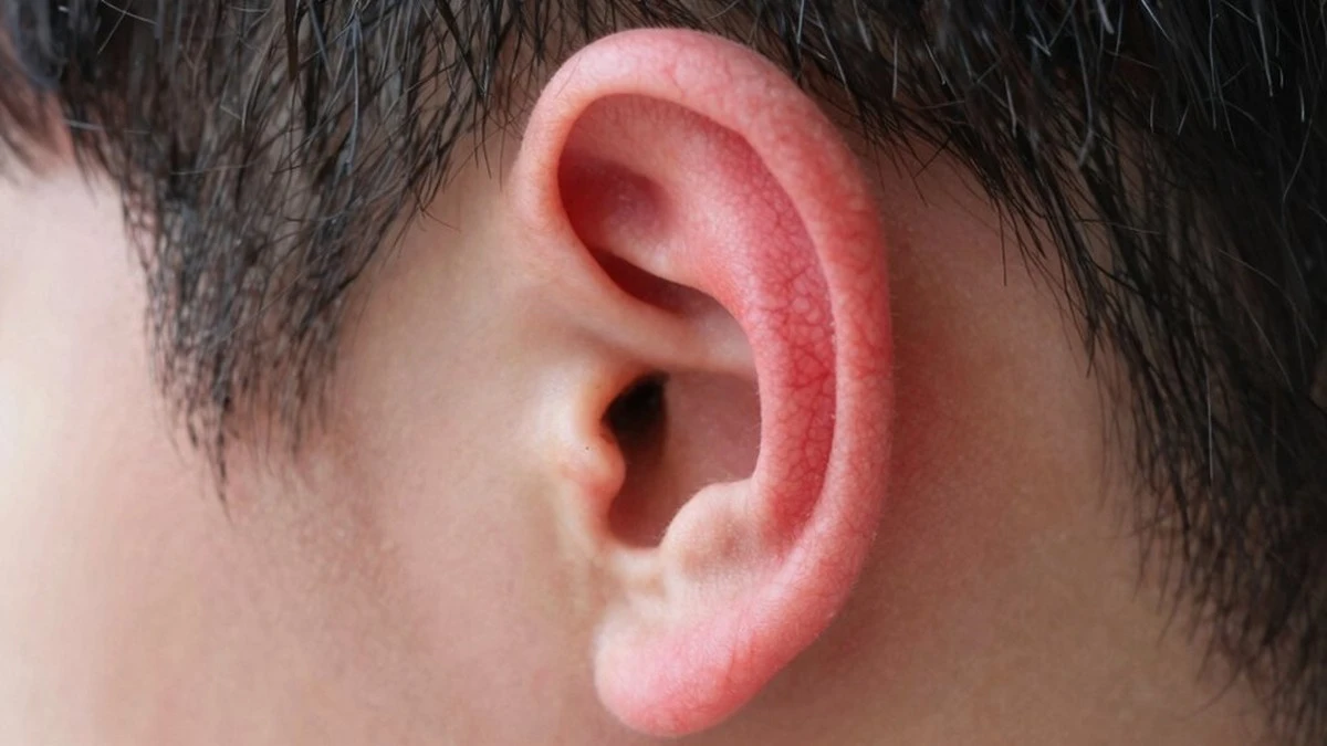 Tus orejas rojas: la verdad que tu médico te dirá (y nada tiene que ver con chismes)